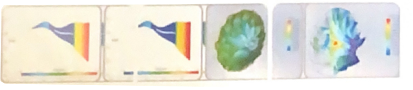 Air Suspension Blower Air Suspension Blower